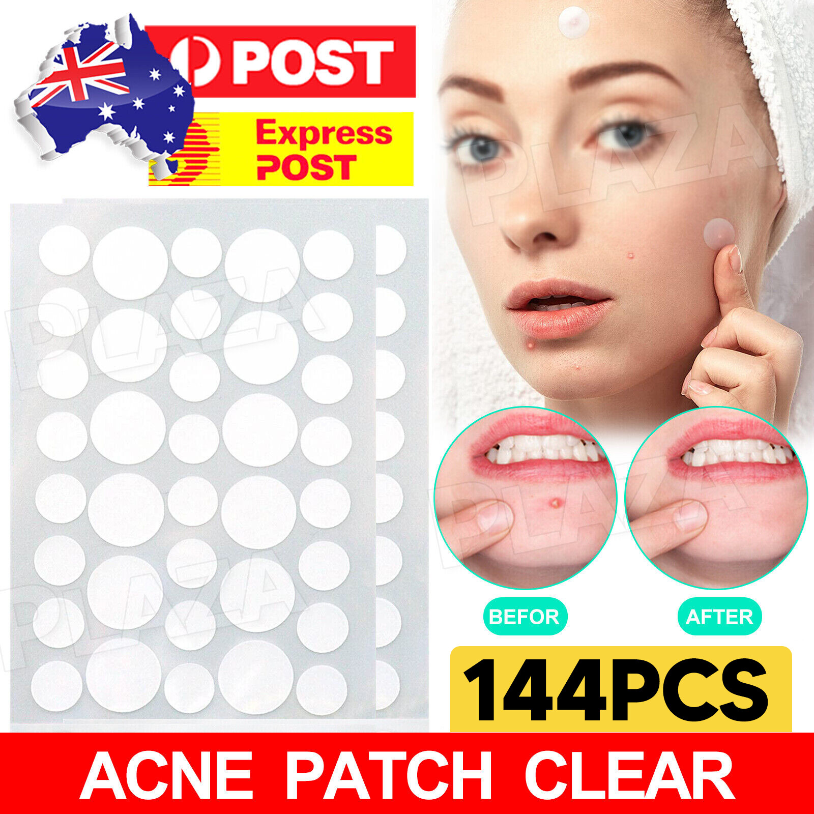 144pcs Acne Patches Clear Breathable Face Blemishes 8mm 12mm polyurethane film