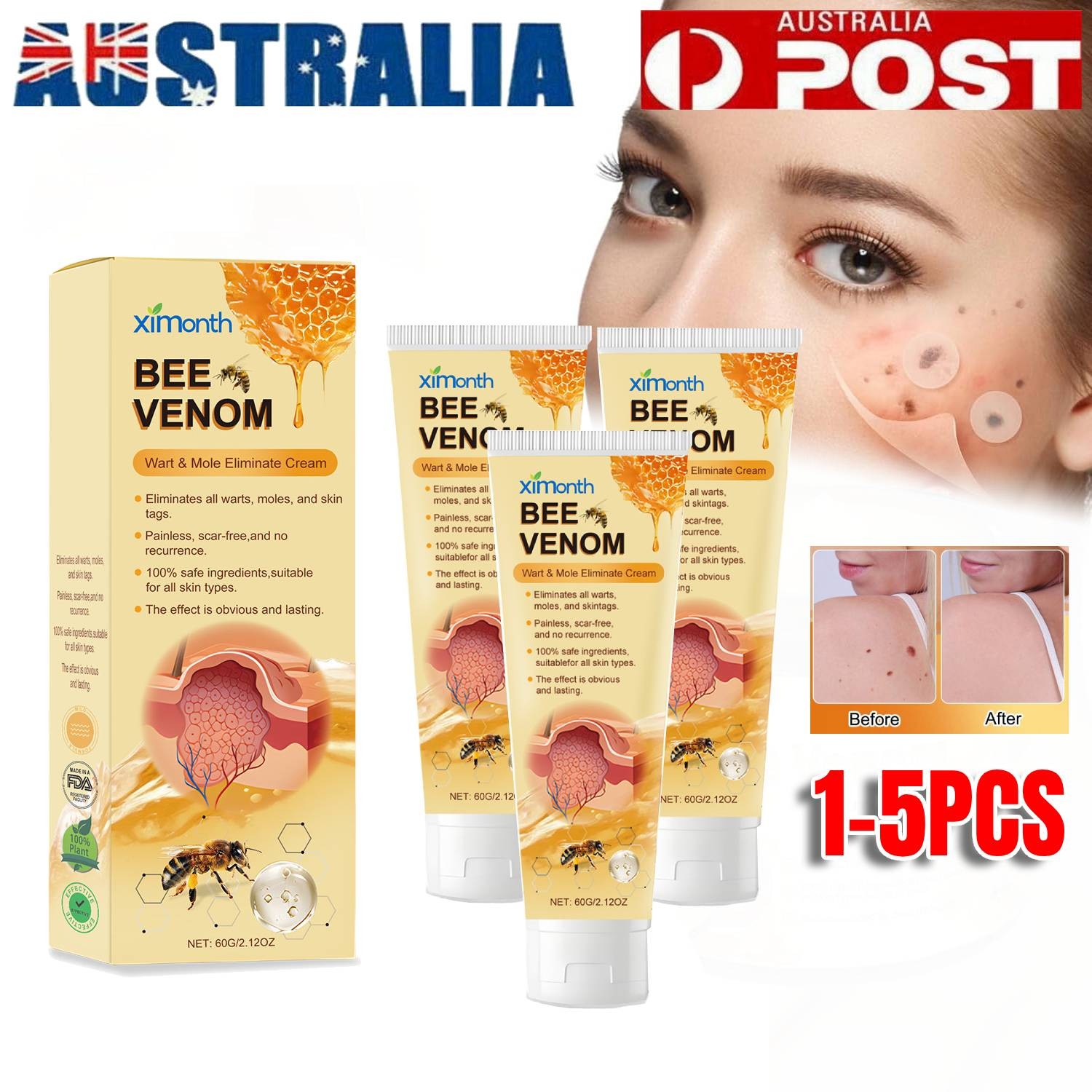1-5x Bee Venom Skin Tag Wart Mole Corn Removal Cream 60g All Types Fast-acting