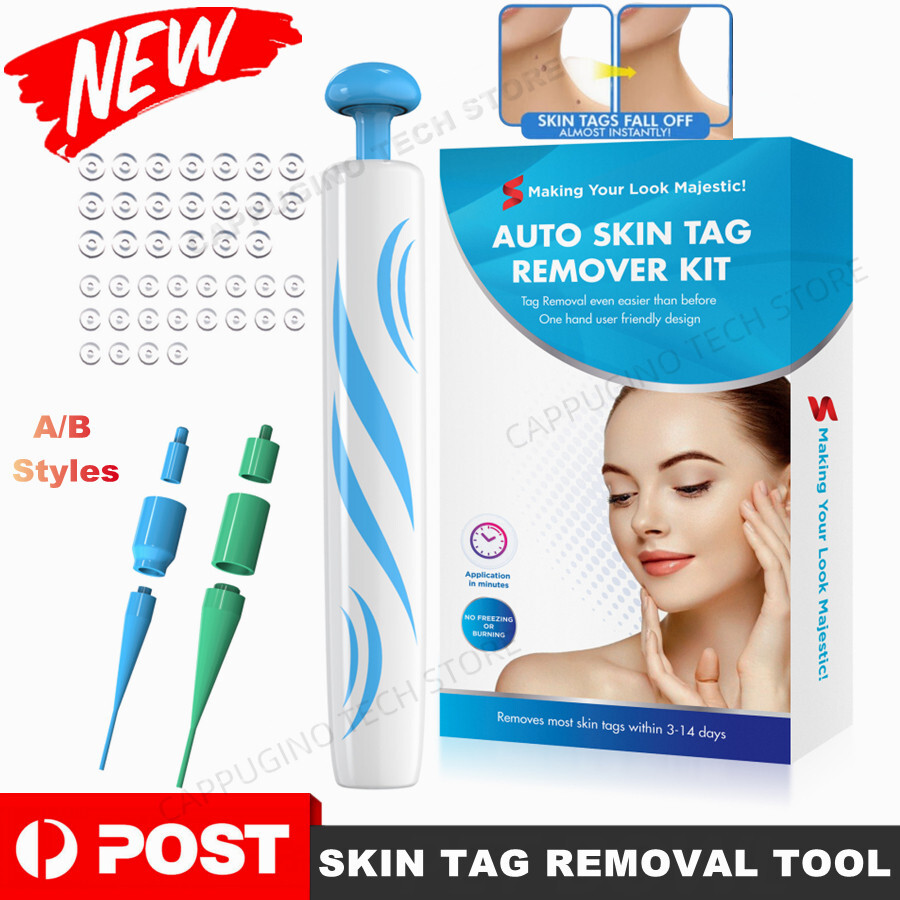 Natural Painless Skin Tag Mole Wart Removal Kit Auto Bands Remover Acne Blemish